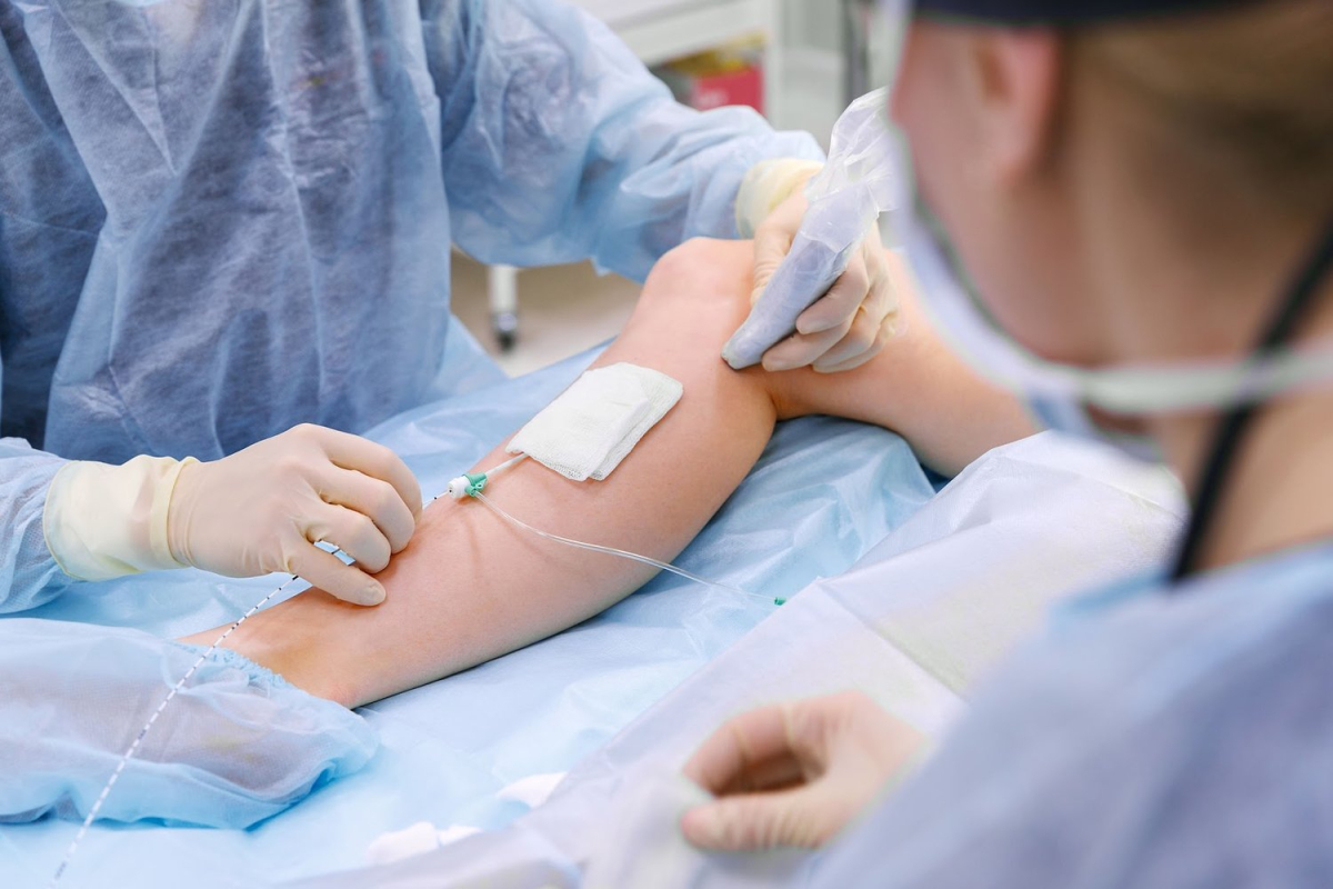 Surgical team performing endovenous ablation on a patient's leg for varicose veins