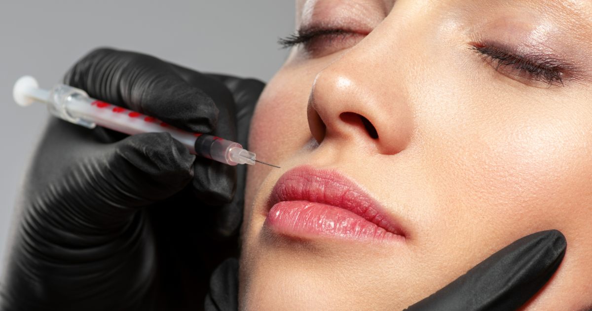 Collagen Stimulator Biostimulators Canberra