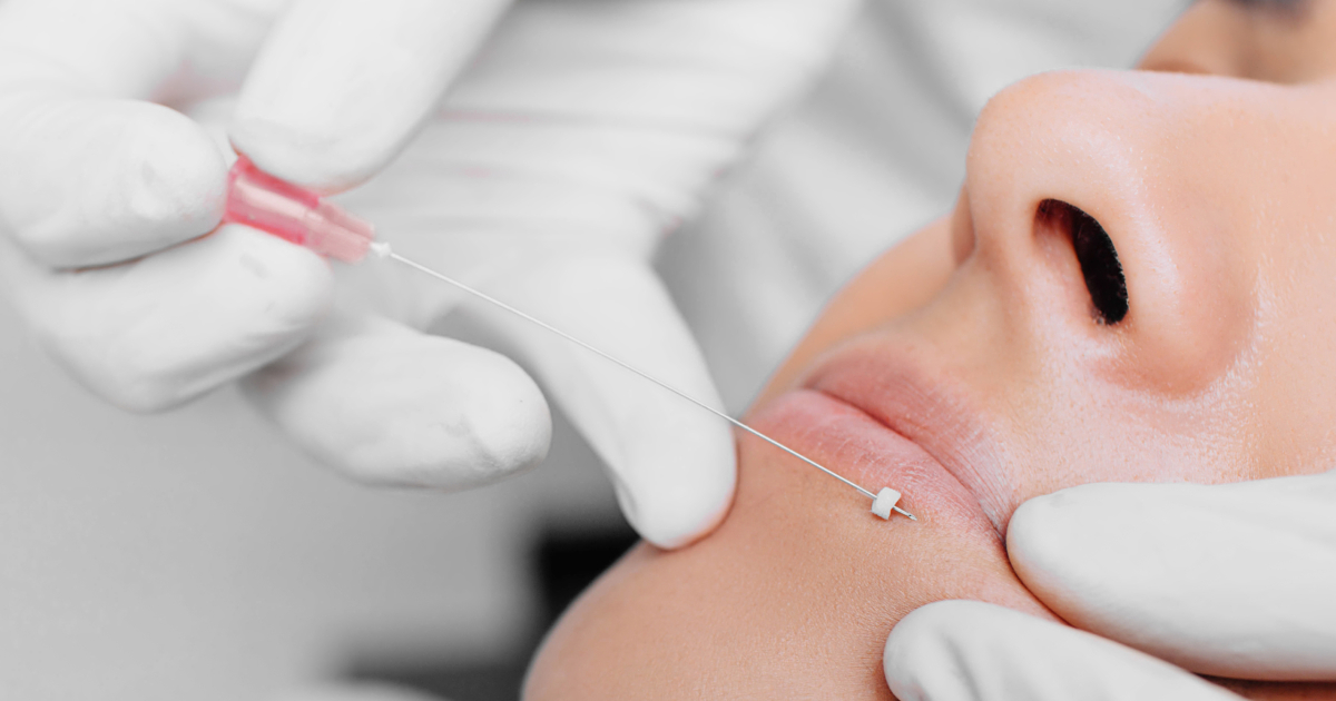 PDO Mono Threads Rejuvenating Thread Canberra