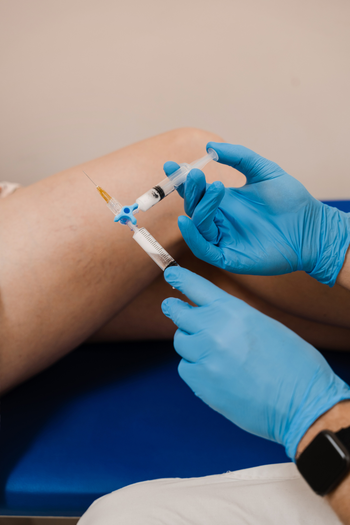 Foam sclerotherapy injection being given into leg veins at Canberra Vein Care