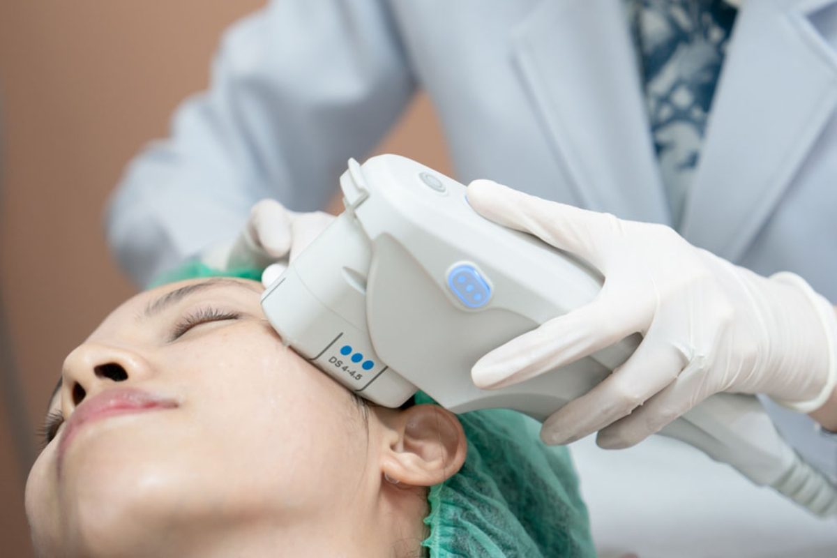 Practitioner performing Ultherapy ultrasound skin lifting on a patient's face